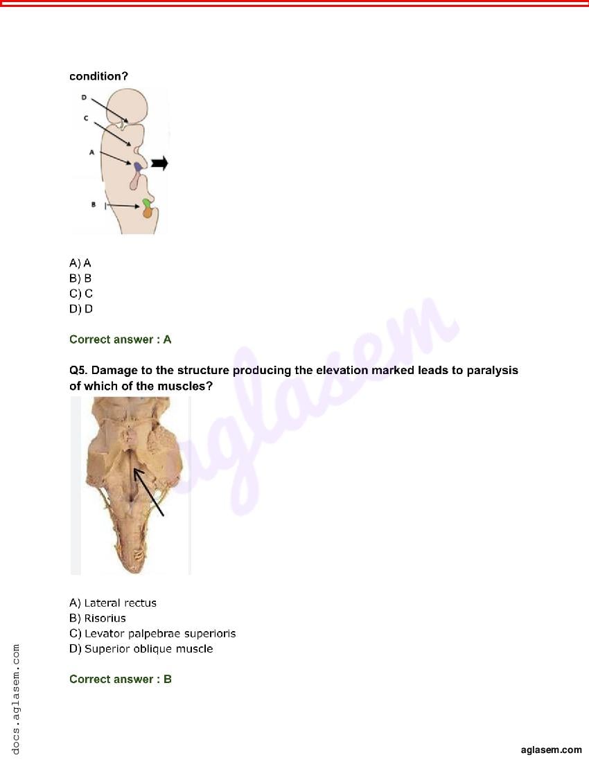 INI CET 2022 Question Paper PDF (May and Nov, 37 Subject Papers)